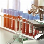 Mellemside, HEMATOLOGY, mikroskop ved siden af 20 blodprøver