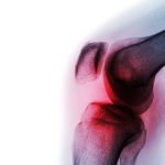 CAG ROAD, transparant knæ, røde knogler, gråt ben, hvid baggrund