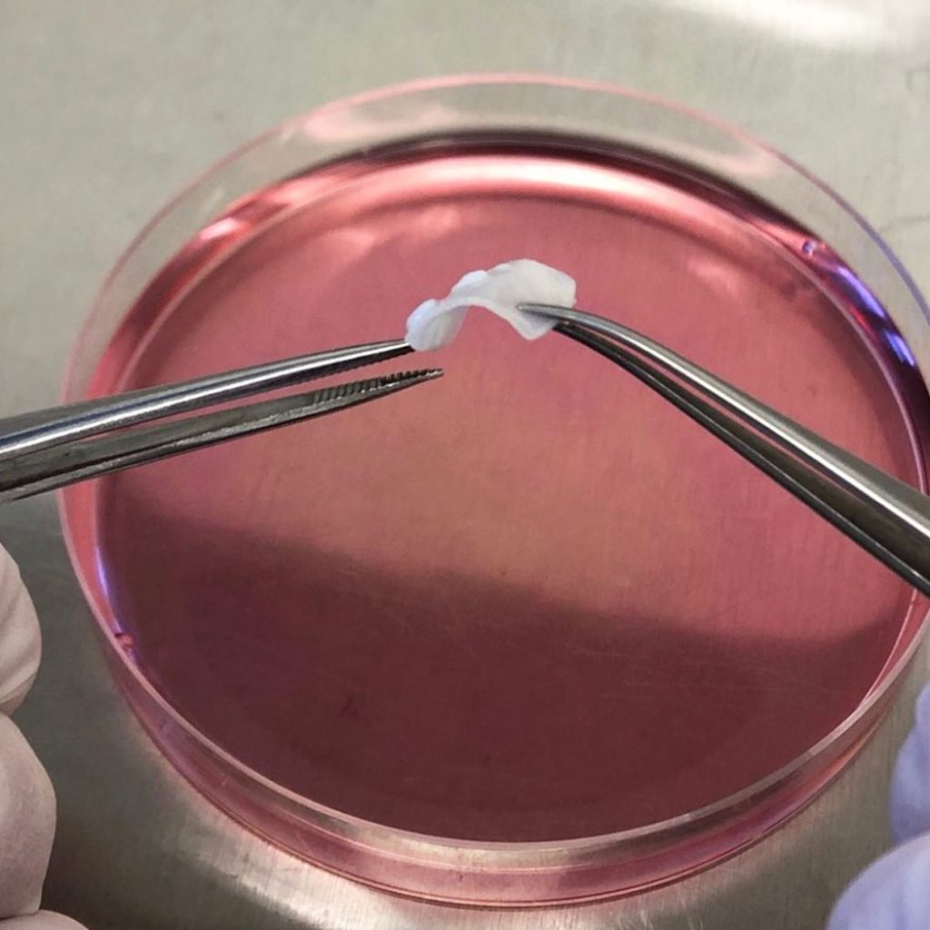 CAG SURF, petri dish and tissue