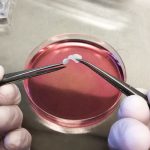 Regenerative Medicine for Urogenital Surgery and Fertility