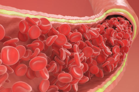 CAG The Zealand Inflammation Research Initiative (ZIRI)