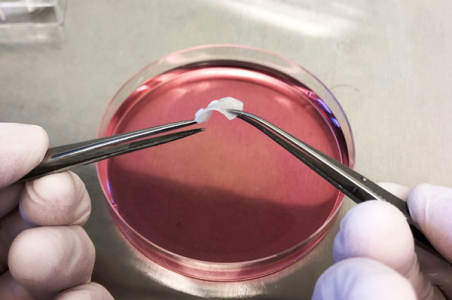 CAG Regenerative Medicine for Urogenital Surgery and Fertility (SURF)