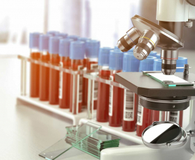 Together we strive to improve treatment, quality of life and survival for patients with blood cancer